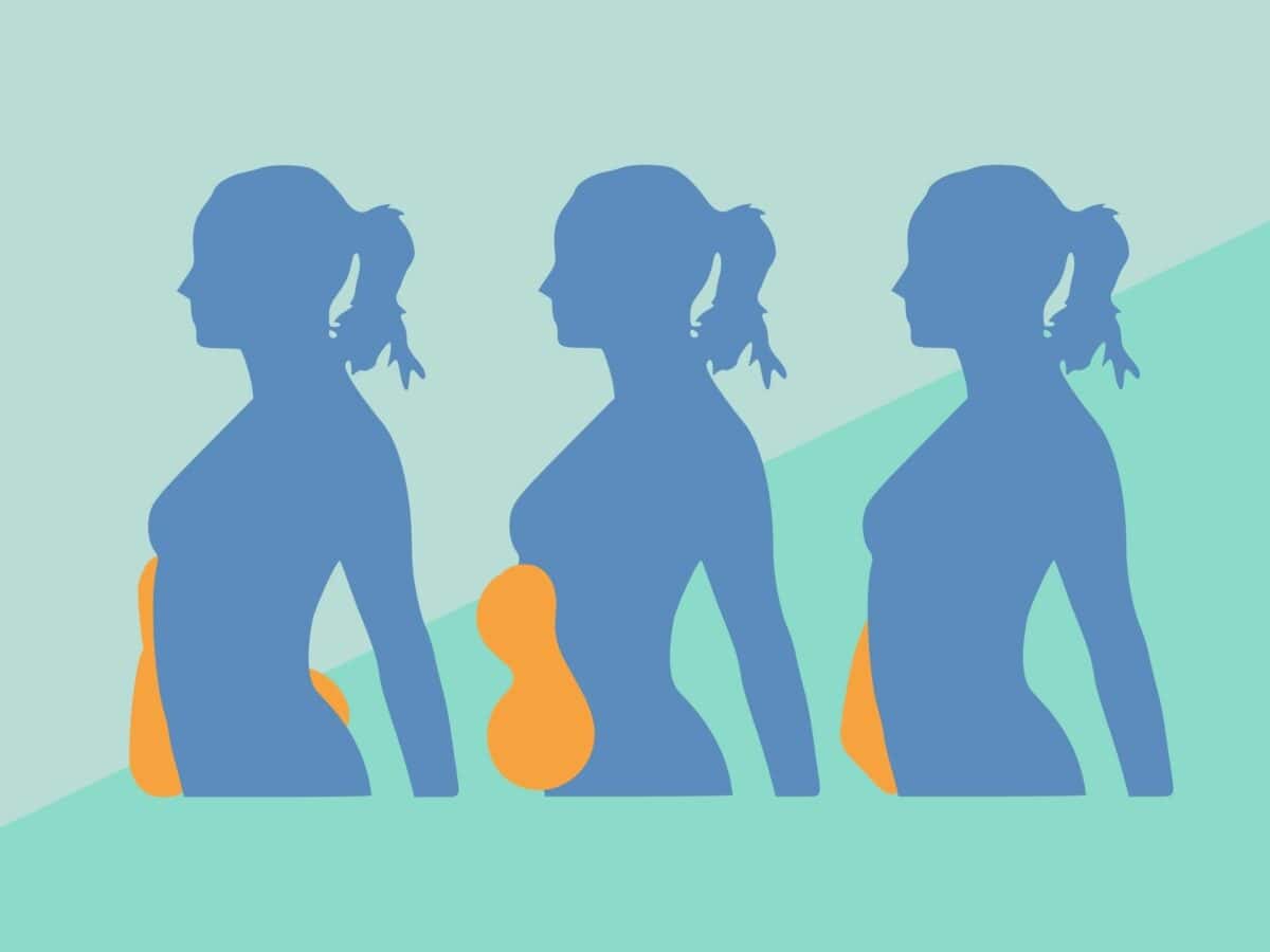 bauchfett bei frauen ursachen verteilung