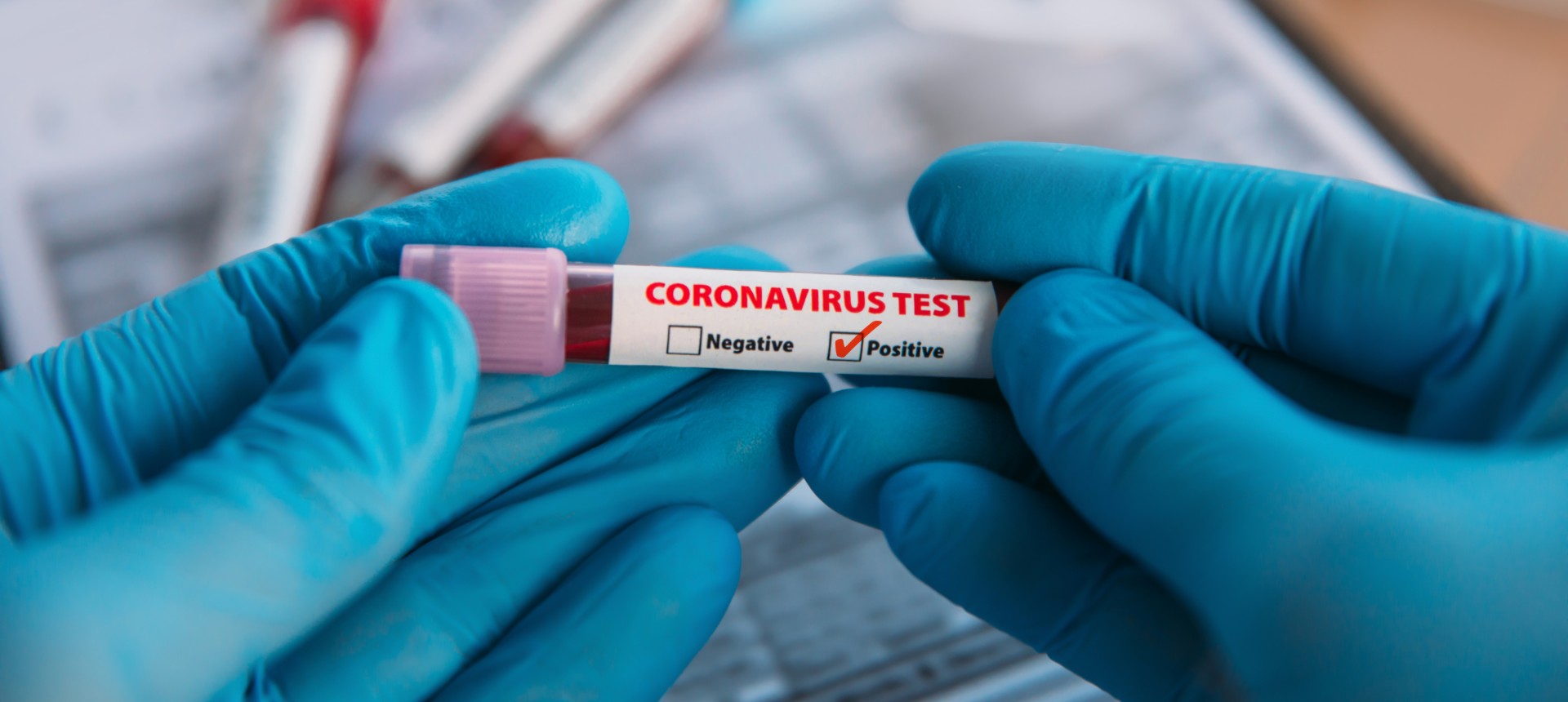 Blutgruppe Corona Test