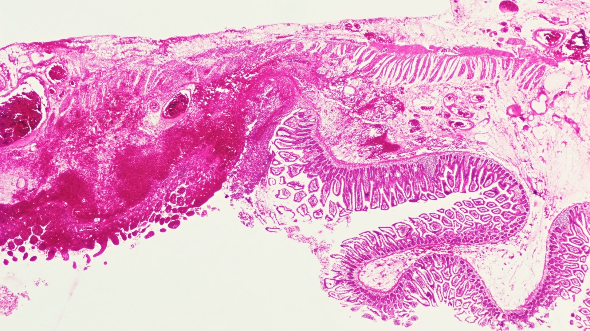 Digestive System