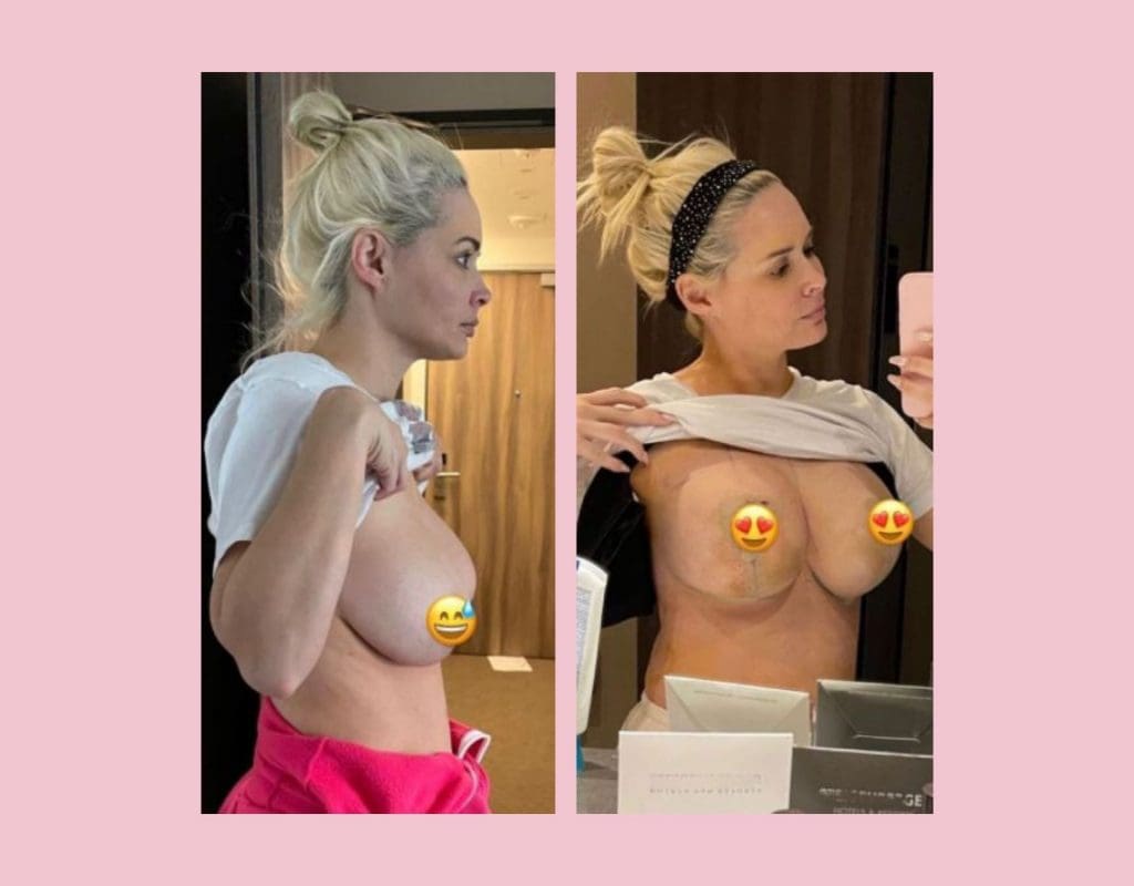 Daniela Katzenbergers neue Brüste