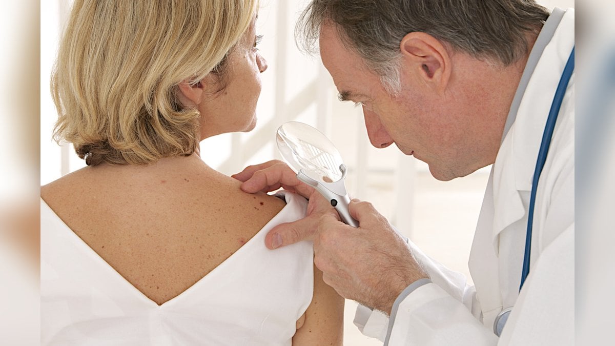 Die Zahl der Hautkrebsdiagnosen nimmt von Jahr zu Jahr zu.. © JPC-PROD/Shutterstock.com