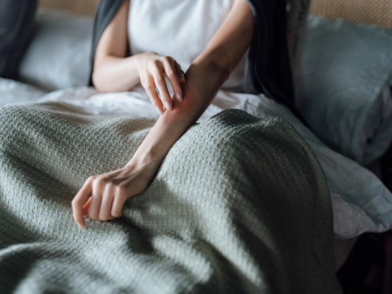 mückenstich frau schmerz bett decke