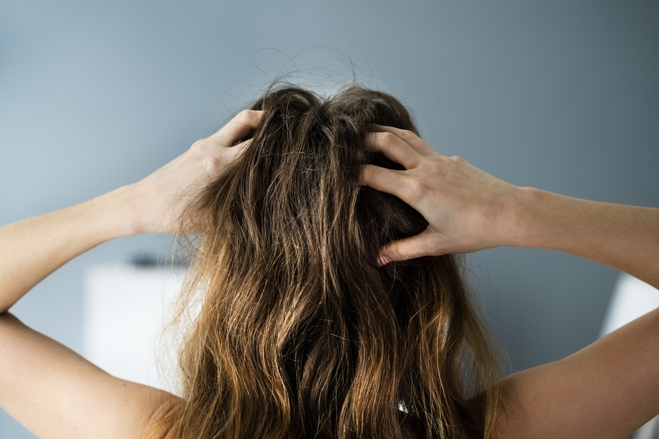 Wypadanie włosów u kobiet: nie, to nie jest normalne