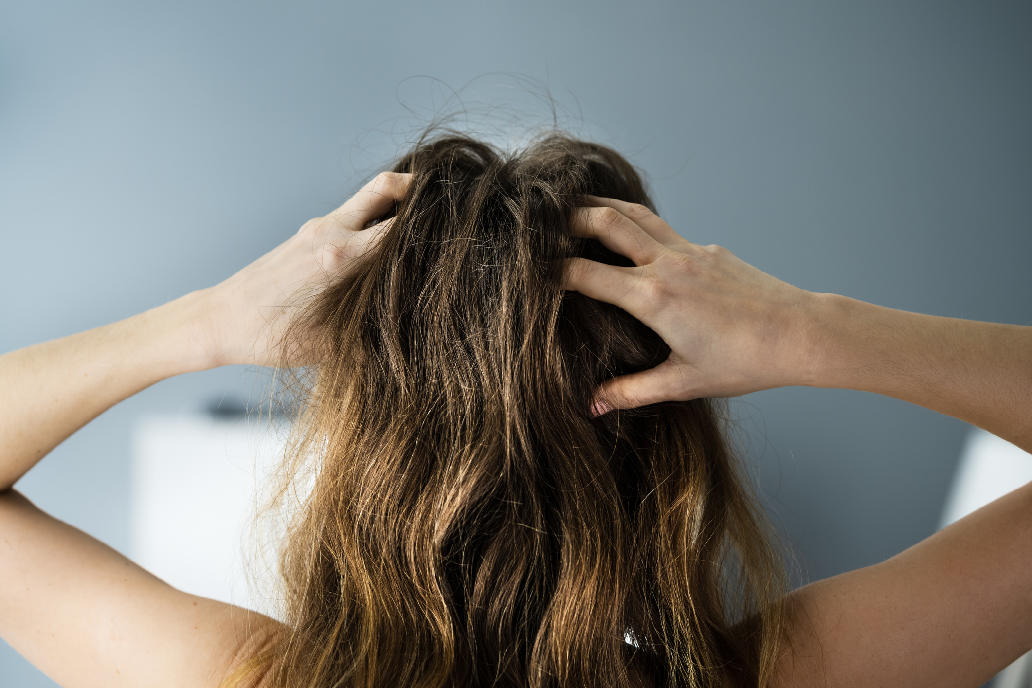 Perdita di capelli femminile: no, non è normale