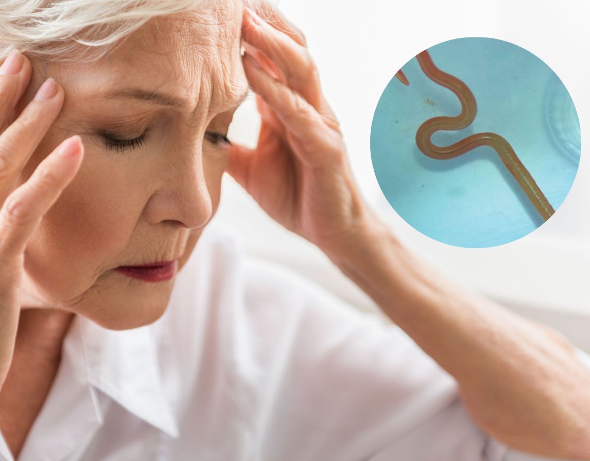 Frau klagte über Bauchschmerzen und Gedächtnisverlust: In ihrem Hirn fand man einen Wurm! (Symbolbild)