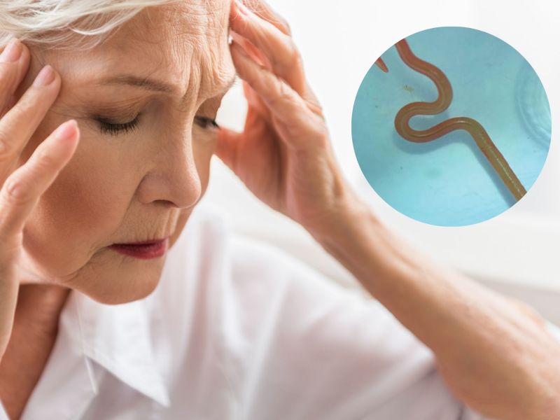 Frau klagte über Bauchschmerzen und Gedächtnisverlust: In ihrem Hirn fand man einen Wurm! (Symbolbild)
