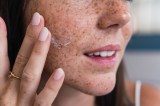 Frau trägt Creme auf